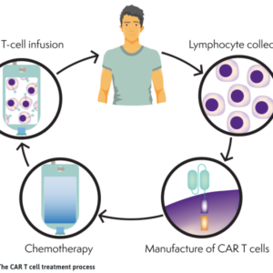 The CAR T-cell process