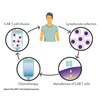Image showing car t-cell process from initial collection of T-cells, to being modifies in the lab and then returned to patient